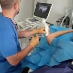 Infiltración ecoguiada del nervio cubital en Madrid-Dr Bellon- Unidad del dolor