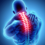 Ecografía musculoesquelética para tratamiento del dolor cervical